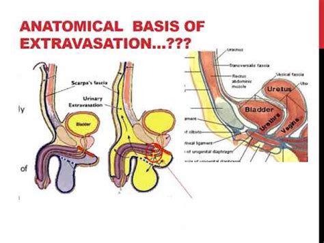 what is a gooch on the human body|Perineum